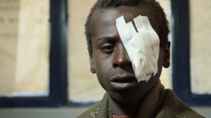 eyetreatment