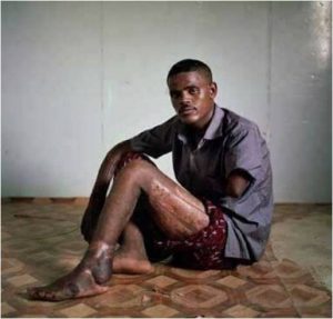 Abebe Kassie, a Brave Ethiopian and a Victim of a TPLF Terror House